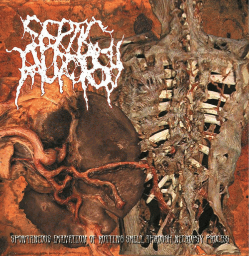 Spontaneous Emanation of Rotting Smell Through Necropsy Process